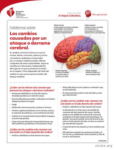 ¿Es posible recuperarse de una lesión cerebral en el lado izquierdo? Explorando los límites de la neuroplasticidad moderna