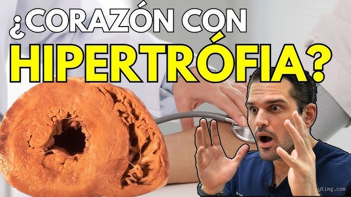 ¿Es posible revertir el daño causado por la hipertensión? La cruda realidad científica tras el asesino silencioso