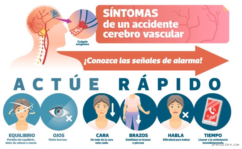 ¿Existen señales días antes de sufrir un derrame cerebral? La verdad médica tras los síntomas silenciosos