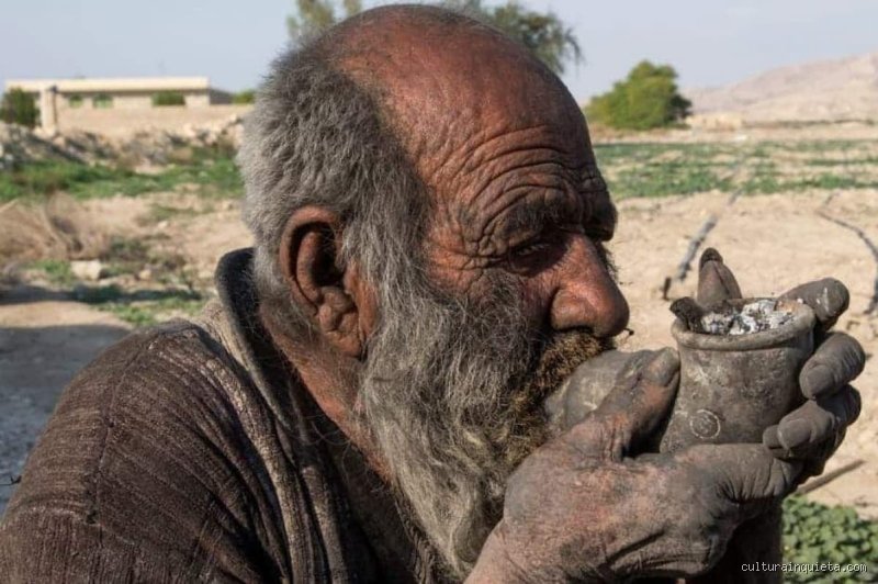 ¿Hombre lleva 60 años sin ducharse? La perturbadora verdad tras el mito de Amou Haji y la ciencia de la costra humana