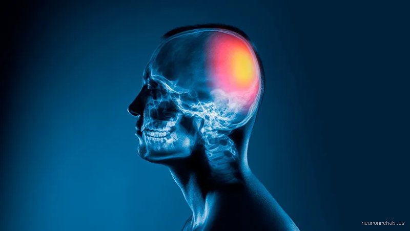 ¿La lesión cerebral adquirida es salud mental? El laberinto invisible donde la neurología y la psique se fundan en uno solo