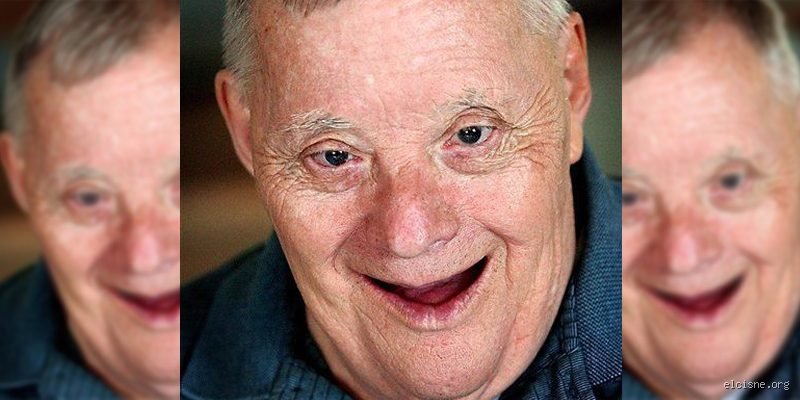 ¿Las personas con síndrome de Down padecen Alzheimer? Entendiendo la conexión genética y el desafío del envejecimiento cognitivo