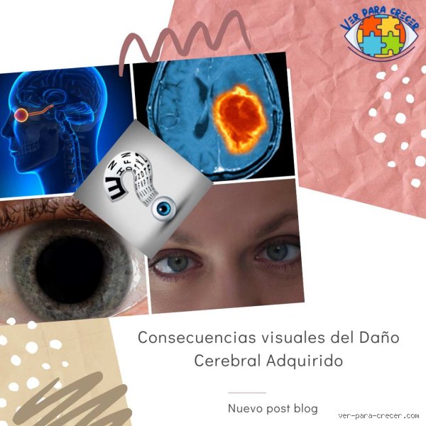 ¿Puede empeorar el daño cerebral con el tiempo? La cruda realidad tras el impacto inicial y sus efectos tardíos
