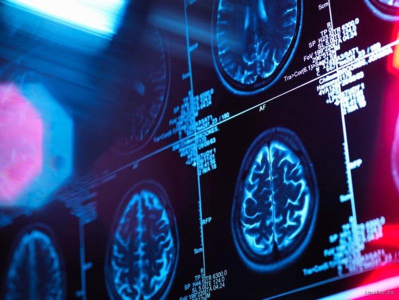 ¿Puede la demencia empeorar rápidamente? Claves para entender cuando el declive cognitivo pisa el acelerador