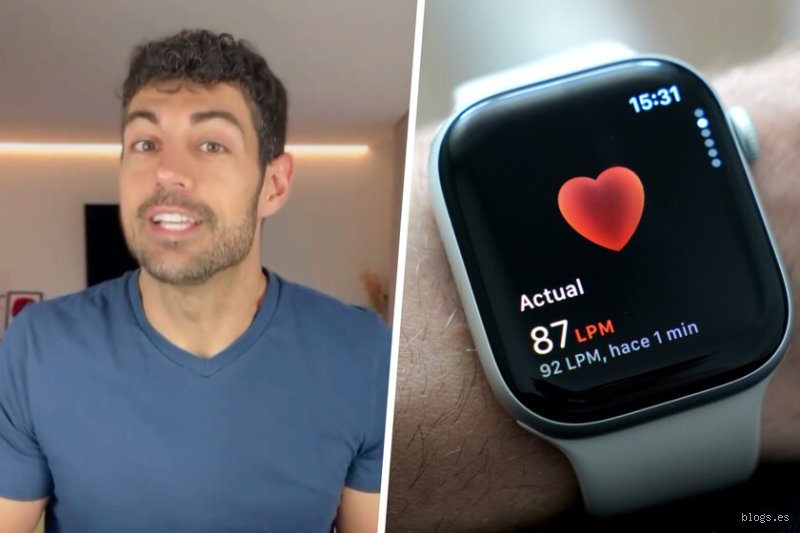 ¿Recomiendan los cardiólogos el Apple Watch como una herramienta clínica fiable o es solo un juguete de lujo?