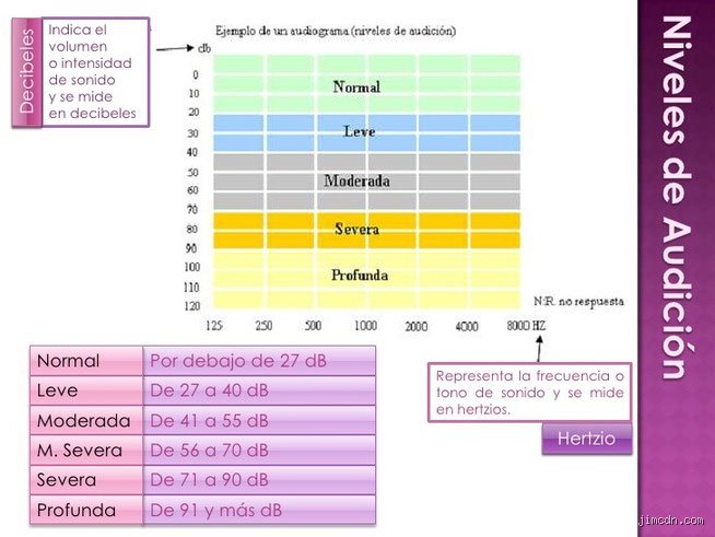 ¿Una audición de 20/25 es buena o estamos ante el inicio de un problema invisible pero real?