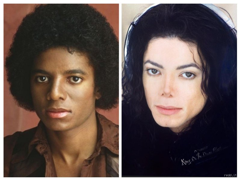 ¿Cambió realmente la voz de Michael Jackson? Un análisis técnico sobre el mito de la eterna laringe infantil