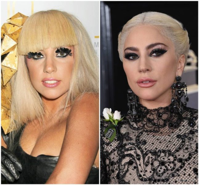 ¿Lady Gaga está operada?