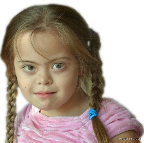 ¿Es posible que existan niños con síndrome de Down y altas capacidades intelectuales o talentos excepcionales?