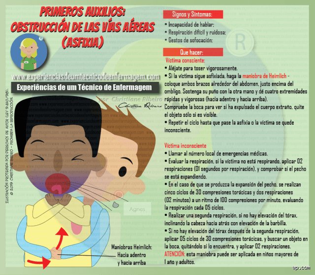 ¿Cuál de los siguientes síntomas puede indicar una obstrucción de las vías respiratorias? Guía de detección crítica para salvar vidas