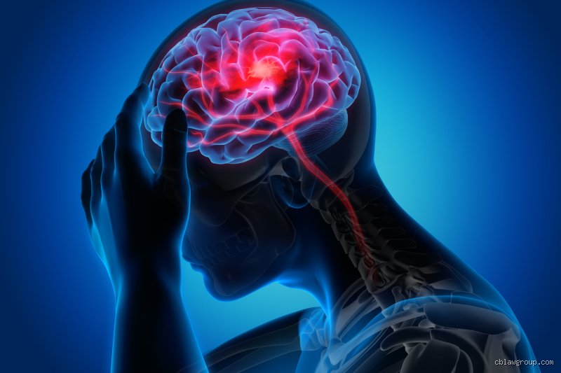 Explorando el abismo de la neurología: ¿Cuál es el daño cerebral más grave y cómo redefine nuestra propia existencia?
