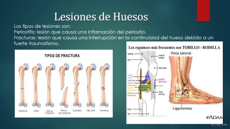 Comprender a fondo cuáles son los 4 tipos de lesiones para prevenir el desastre físico