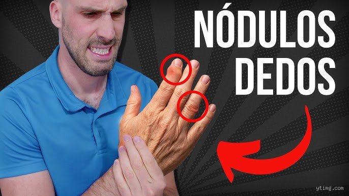 ¿De verdad funcionan los ejercicios para los dedos o estamos perdiendo el tiempo apretando pelotas de goma?