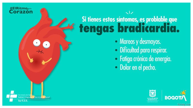 ¿Dónde duele la bradicardia? Descifrando el silencio de un corazón que late demasiado despacio