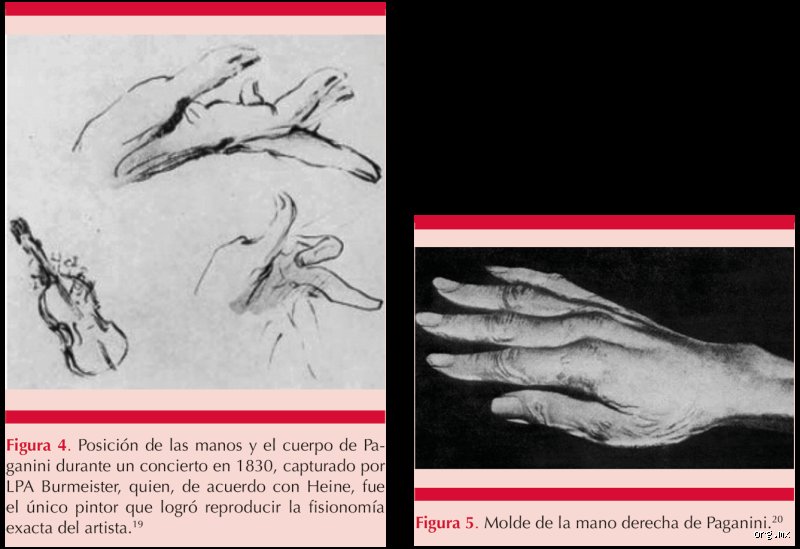 El martirio del violín: ¿Cómo murió Niccolò Paganini y qué secretos médicos escondía su agonía en Niza?