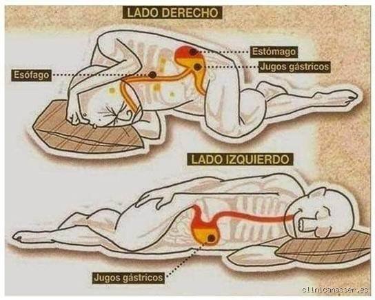 Cómo dormir de lado correcto para transformar tu descanso y proteger la salud de tu espalda hoy mismo