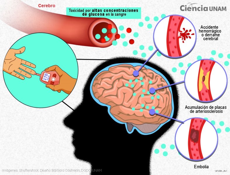 ¿Cuándo se sube el azúcar duele el cerebro?